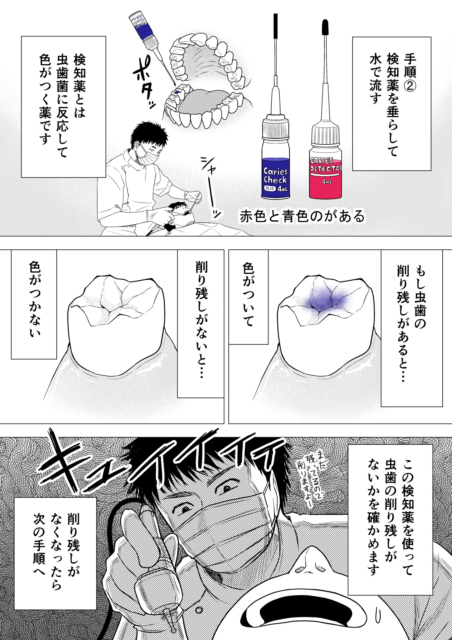 歯医者さんの治療の手順！何をしているのか分かりやすい！
