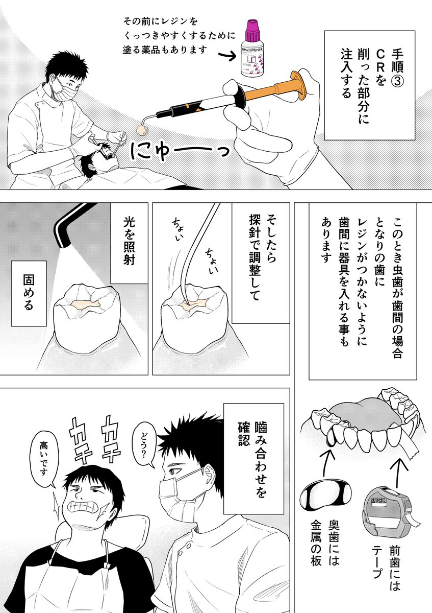 小西真冬先生のマンガ 何されてるかわからない人向け 歯の治療手順 を読んで何をしていたのか理解して安心する人々 Togetter 小西真冬先生のマンガ 何されてるかわからない人向け 歯の治療手順 を読んで何をしていたのか理解して安心する人々 Togetter