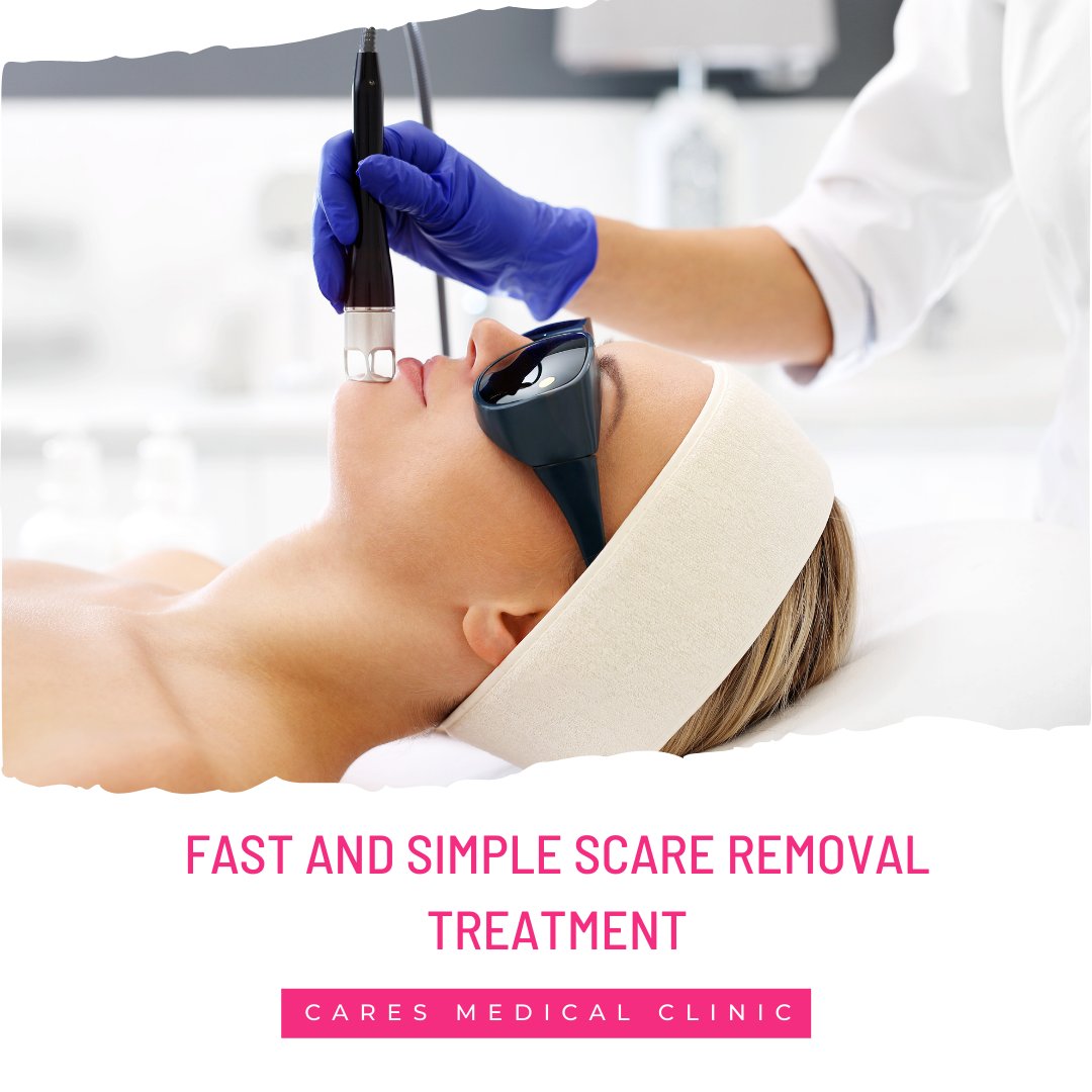 Health_Local's tweet photo. The ICON fractional laser system is a fast, simple, and effective treatment option for scar removal. Read this article by Cares Medical Clinic to learn more: https://t.co/53VvfyFoDL

#calgary #alberta #walkinclinic https://t.co/0wZDyroOW0