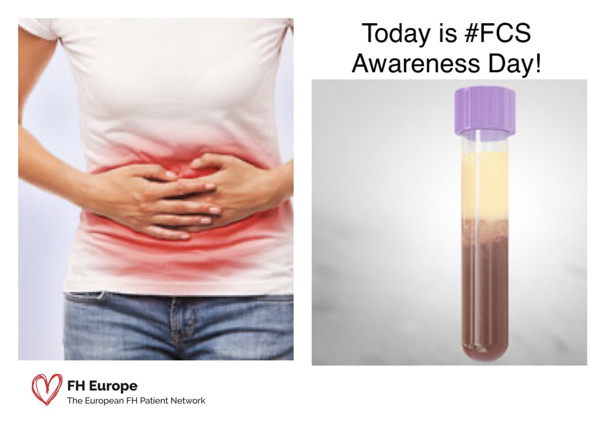 fhpatienteurope's tweet photo. Today is #FCS Awareness Day!
Familial chylomicronemia syndrome (FCS) is a #raredisease. People with FCS can't eat #fat as they don't have the enzyme which breaks it down.
Itโs a #genetic #lipid #disorder, meaning it is passed down from parents, present from birth. #FindFCS https://t.co/che9k7RAfi