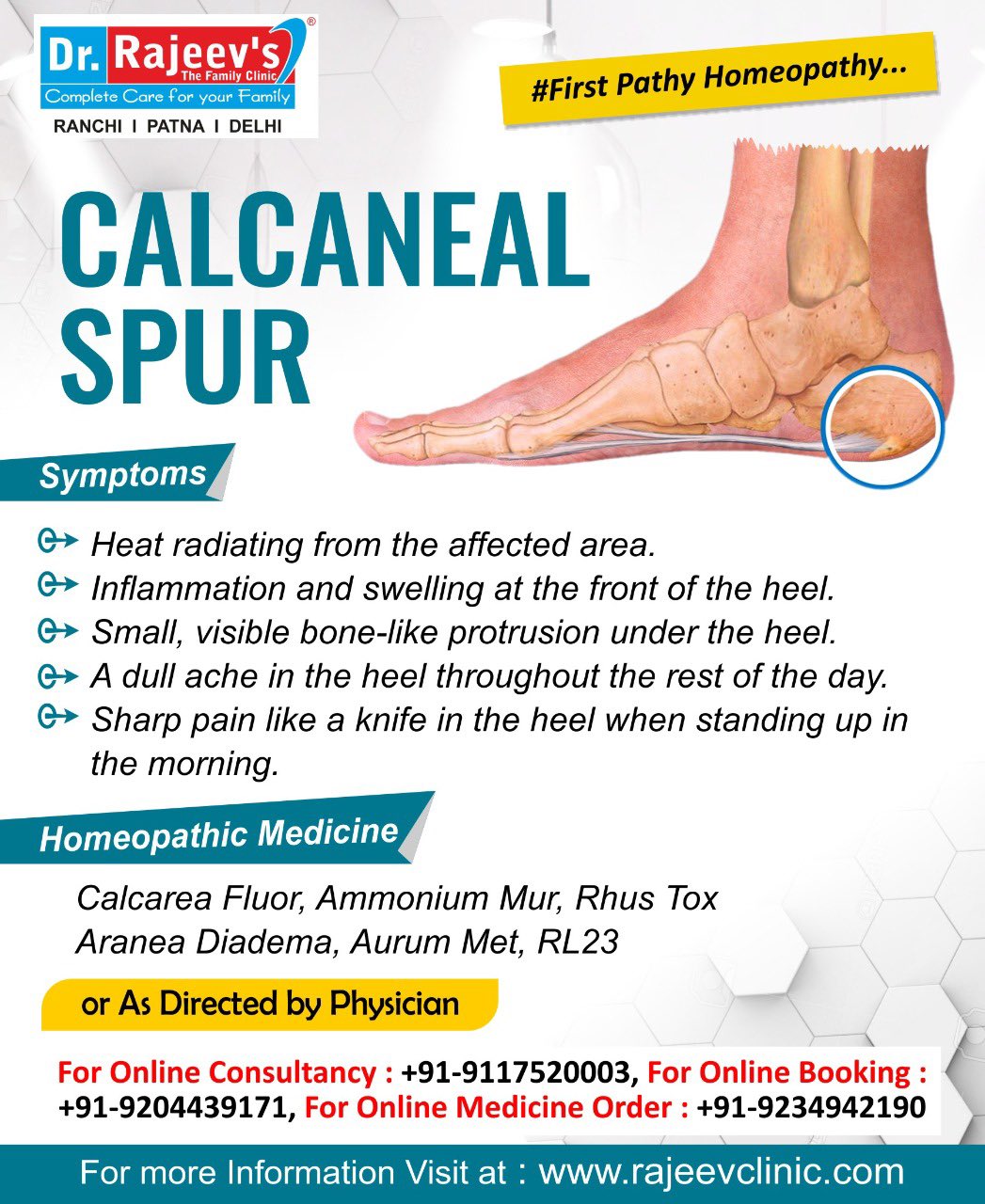 Dr Rajeev Kumar on X Heel Pain Don t Worry https t cp5JXmAV50 X