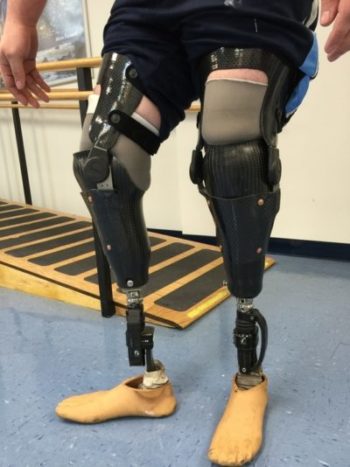 MedicalCenterOP's tweet photo. Learn all about our unique, industry-leading approach to custom orthotics at https://t.co/lEb0ogrNx7 👍

#livelife #moveforward #moveforwardMCOP #MCOP #amputee #amputeelife #amplife #medicaldevices #oandp #orthotist #orthotists #orthoticsandprosthetics #prostheticsandorthotics https://t.co/sWbN3CkksF