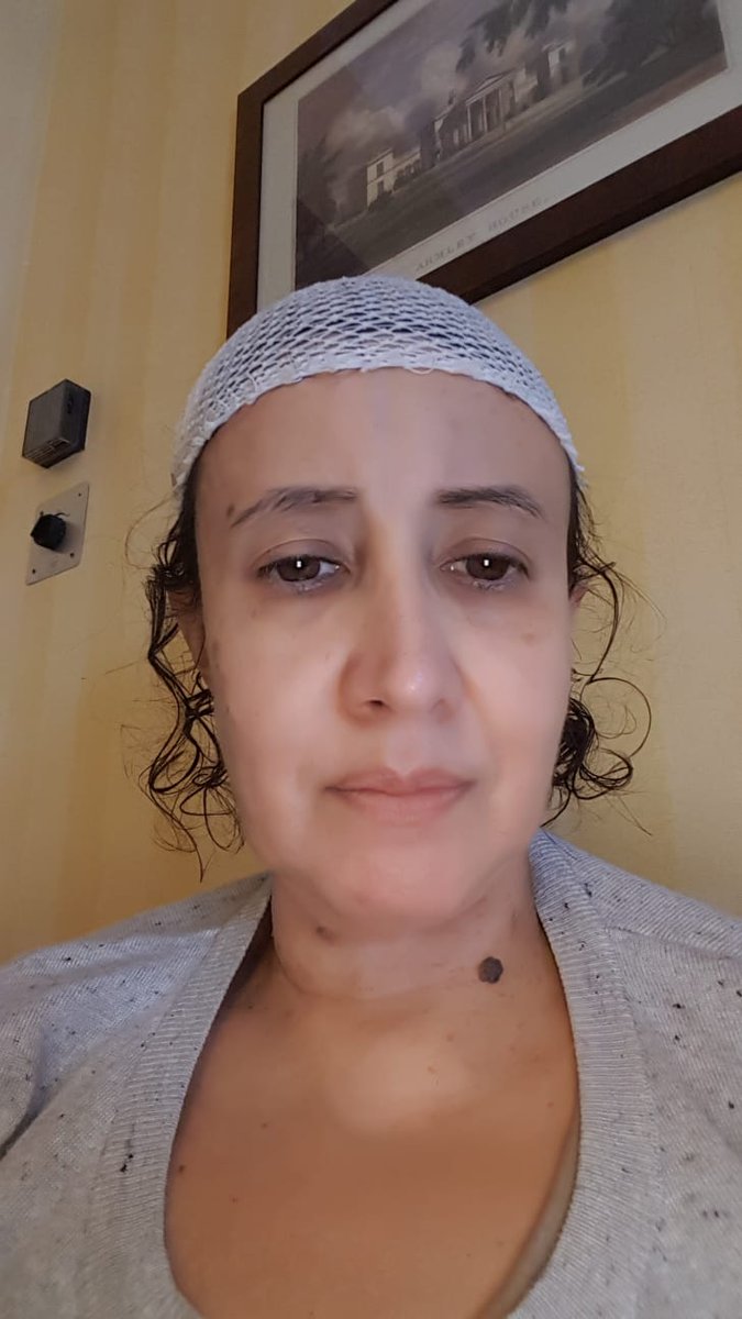Vargasm19690891's tweet photo. Ana survived a long traumatic surgery and needs economic help if possible, thanks https://t.co/eyMg92Zc0D https://t.co/sIrjTOGH5u