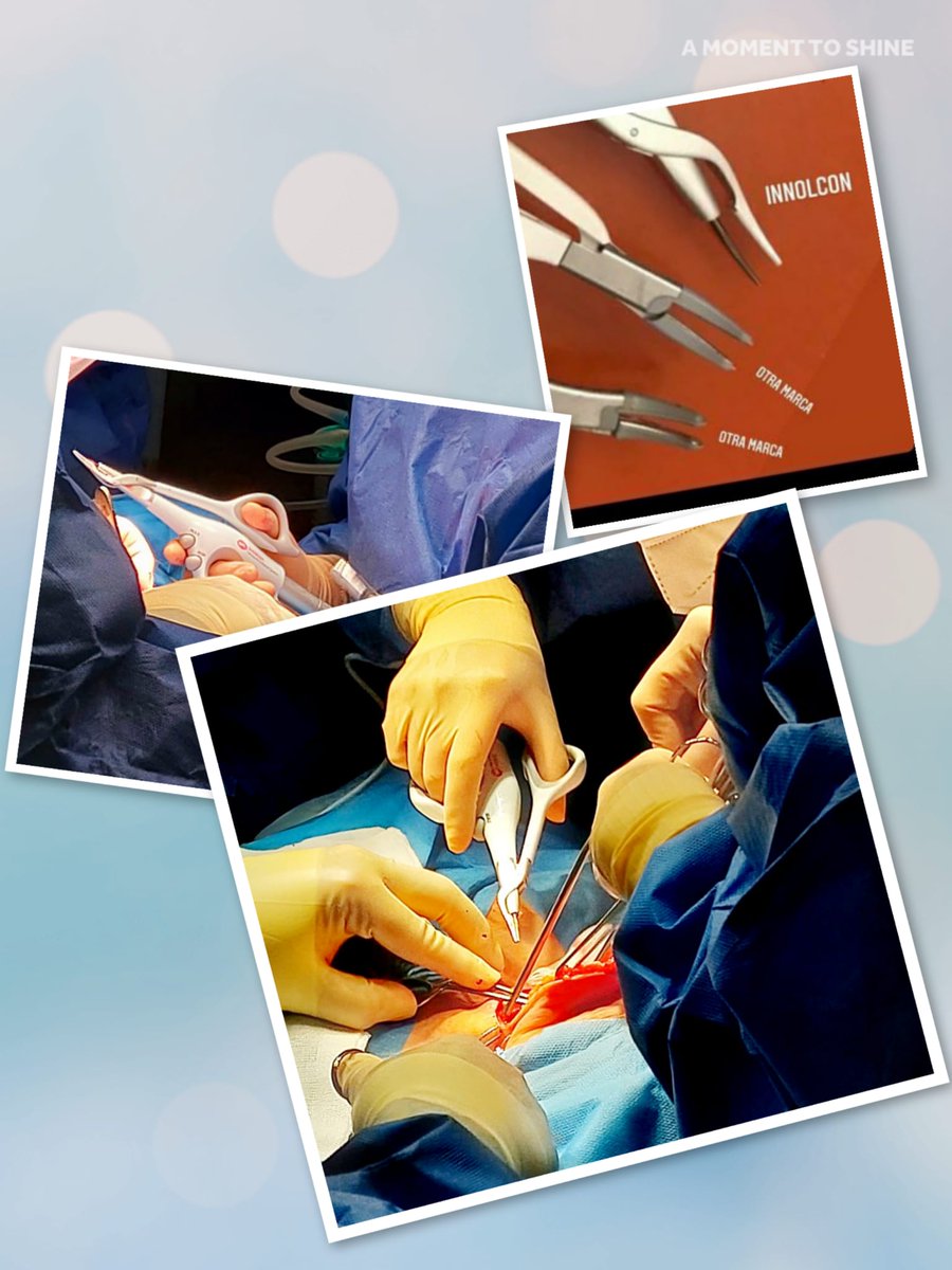 Medical_Canada's tweet photo. Los bisturí SS de Sistema Quirúrgico Ultrasónico Innolcon ofrecen una mayor comodidad en cirugías de la linfadenectomía, de cuello de cabeza, como glosectomías, parotidectomías, tiroidectomías, etc.
#sistemaultrasonico #innolcon #bisturi #medicalcañada https://t.co/s3qIcz86KA