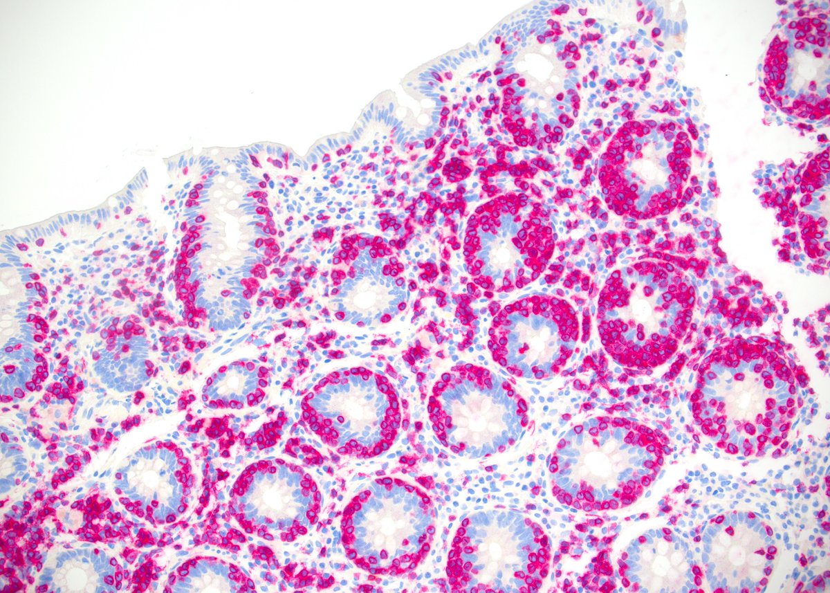 Pathologie_MedUniWien tweet media