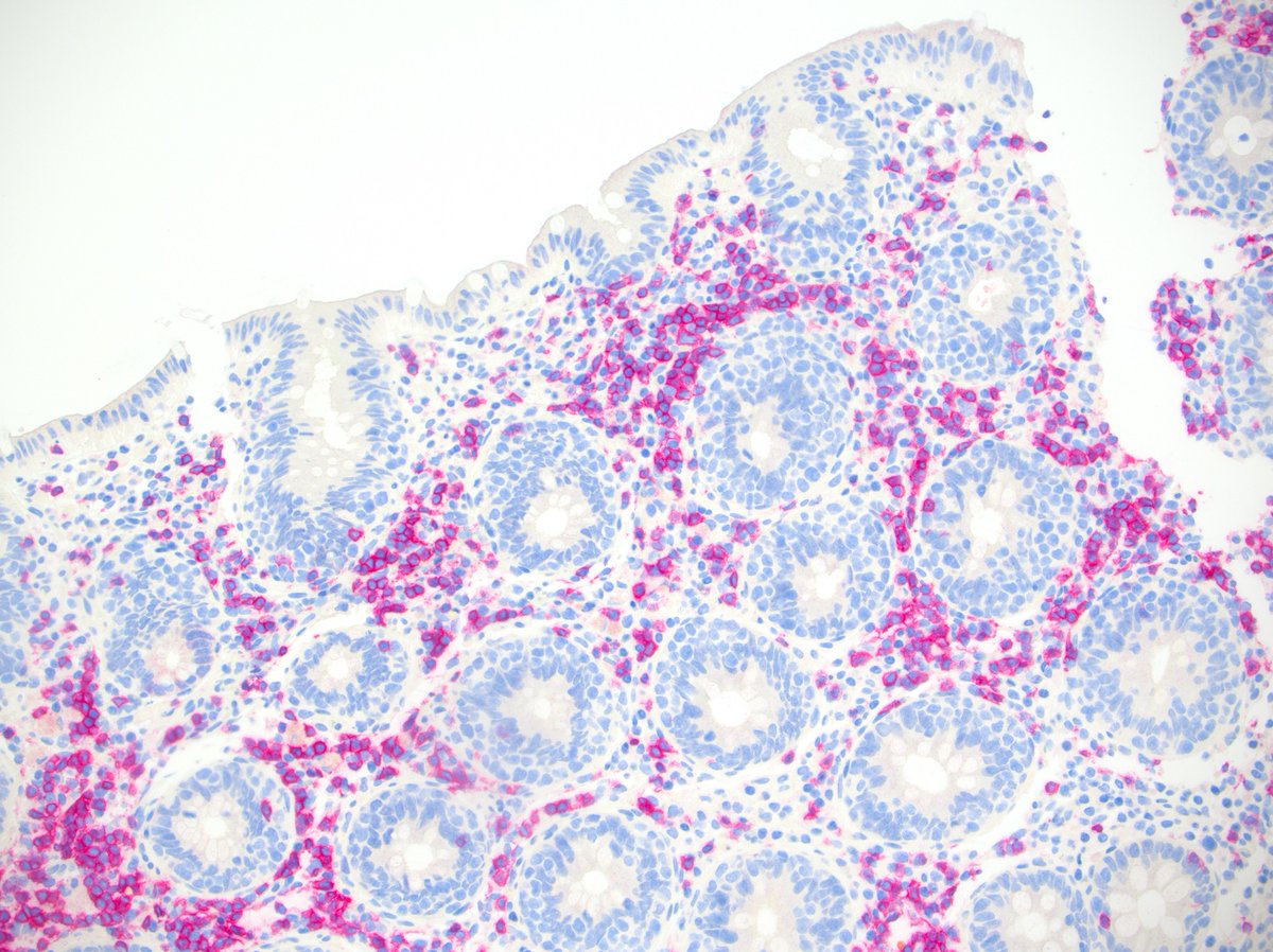Pathologie_MedUniWien tweet media