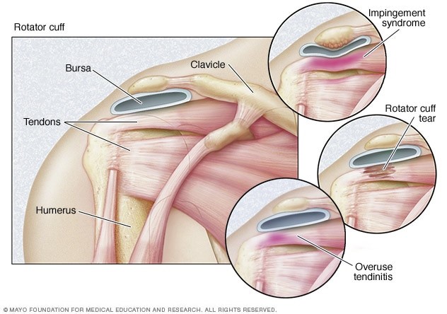 SihamFayyad's tweet photo. https://t.co/EO5mL1YCXH
#خلع_الكتف
#shoulder_dislocation
#الجزء_الثاني https://t.co/k3NOouqv0d