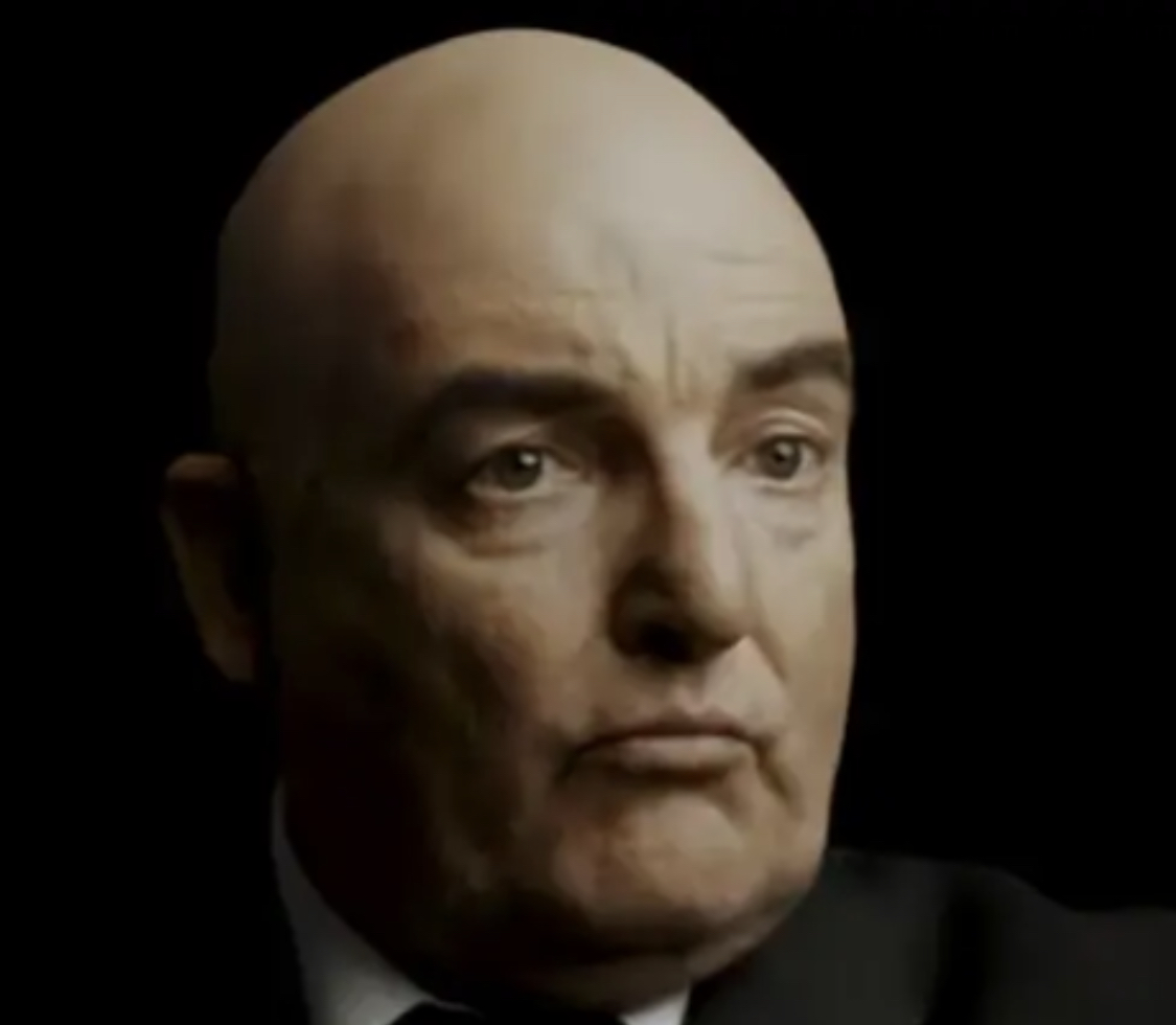 Er weigerte sich, eine 
Cor-ohneHaar-Impfung zu machen. Hier das bedauerliche Resultat, wie Herr Marco Rima nun aussieht. Die Gefahr der Nebenwirkungen war zu gross: Humor, Verstand, Solidarität. Mit diesen Nebenwirkungen kann er nicht Leben #JaZumCovid19Gesetz #JaAusVernunft