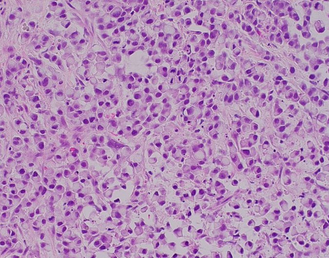 NYULISOM Pathology tweet media