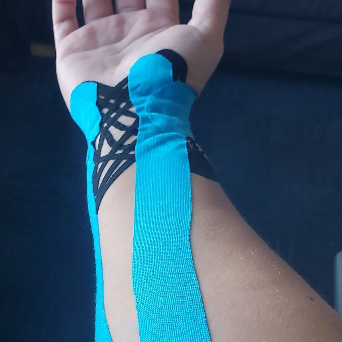 KinesioTape's tweet photo. #Repost @brttny A bonus to working @kinesiotape, when ur in pain u get taped. #EDF (black tape), #Snowflake (pink), Y-strip (long blue) & Web cut (blue). Then a #Kinesio ArmSleeve to protect my taping. #kinesiotape #Kinesiotapingmethod #painrelief #carpaltunnel #tapewithwisdom https://t.co/sCu9zsvYLc