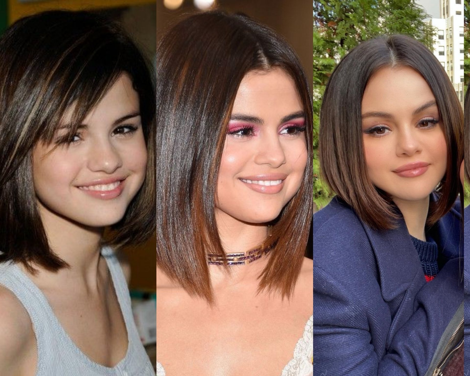 Selena Gomez Nose Job Before And After