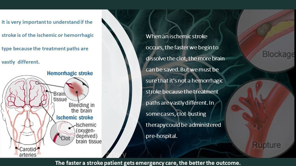 BandB_srl's tweet photo. Timely referral of appropriate patients to stroke units is necessary for the effective provision of skilled care. 
Link https://t.co/RUO8hEFgsC via @Bru_Basile #MedTech #DigitalTransformation #Temnography https://t.co/XteJSjJEJN