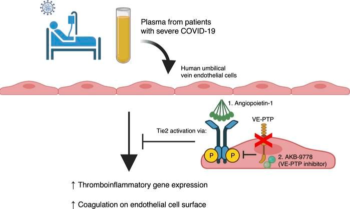 ASCI member @samirparikhmd @UTSWNews in @JCI_insight: Tie2 activation protects against prothrombotic endothelial dysfunction in #COVID_19: buff.ly/3ED2r3d #VascularBiology