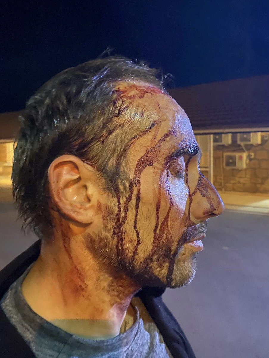 CABS_REPORTS's tweet photo. ⚠️🗞📰 05.11.2021 CABS member seriously injured in violent attack on Cyprus near to an illegal bird trapping installation. More information here: https://t.co/cuJ2mhL4q2 https://t.co/UpKmvGXAsF