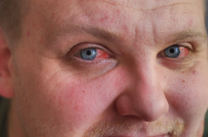 LEGIQN's tweet photo. Sorry, I can't come in to work today https://t.co/2VdZmQOXlO