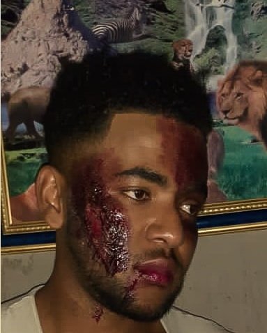 DaudRugunate's tweet photo. Sfx make up by my sis. Please retweet until she get employed

#BBMzansi #RosemaryNdlovu #gomora #GomoraMzansi #DiepCityMzansi #TheQueenMzansi #TheRiver1Magic #Somizi #Uzalo https://t.co/mxL0LHHj4e