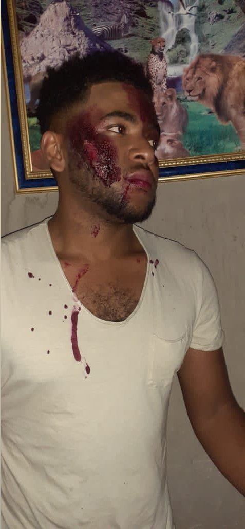 DaudRugunate's tweet photo. Sfx make up by my sis. Please retweet until she get employed

#BBMzansi #RosemaryNdlovu #gomora #GomoraMzansi #DiepCityMzansi #TheQueenMzansi #TheRiver1Magic #Somizi #Uzalo https://t.co/mxL0LHHj4e