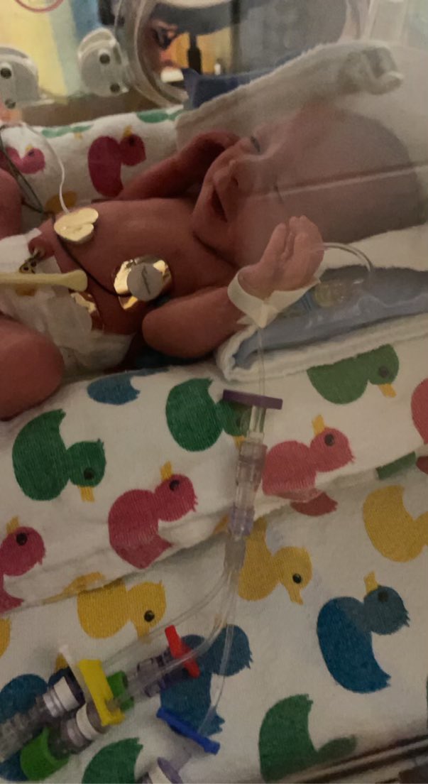 Sarah_Millerrr's tweet photo. Welcome to the world, Hadlee Rose and Dakota Luv! 💖💖 Hadlee was born at 6:42 AM at 4lb 1oz and Dakota was born at 6:43 AM at 5lb 11oz! My girls are both beyond perfect! 🥺🥰💞💞 https://t.co/m86LgSwQKn