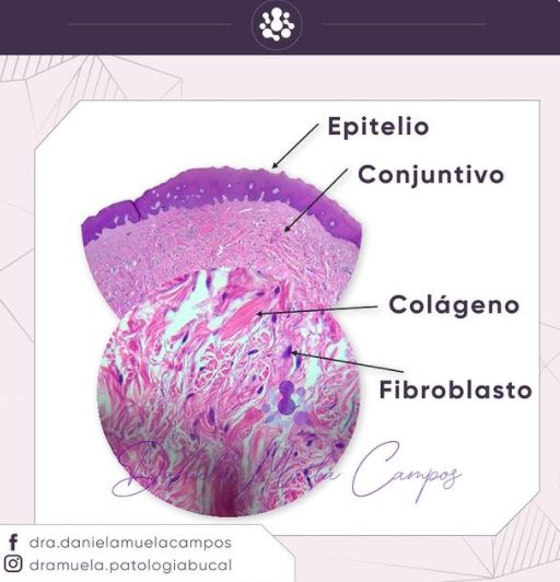 odontologosmx's tweet photo. Los tejidos que conforman la mucosa bucal. https://t.co/0EMhtbawaQ