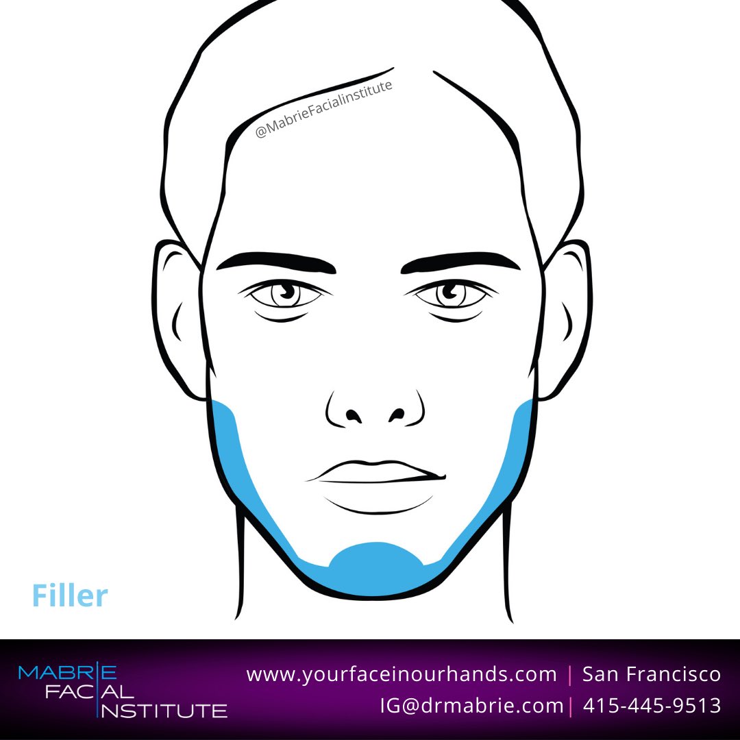 DavidMabrieMD's tweet photo. ‘chiseled for more Sizzle’ 🥵 💜

At MFI, we specialize in helping men create chiseled features and combat signs of aging.

If you’re interested in seeing what dermal fillers can do for your face, set up a consultation now. 💜
#chinandjawlinefiller https://t.co/bNpfoDknlb