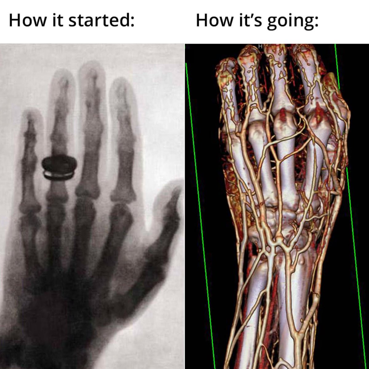 Happy International Day of Radiology!