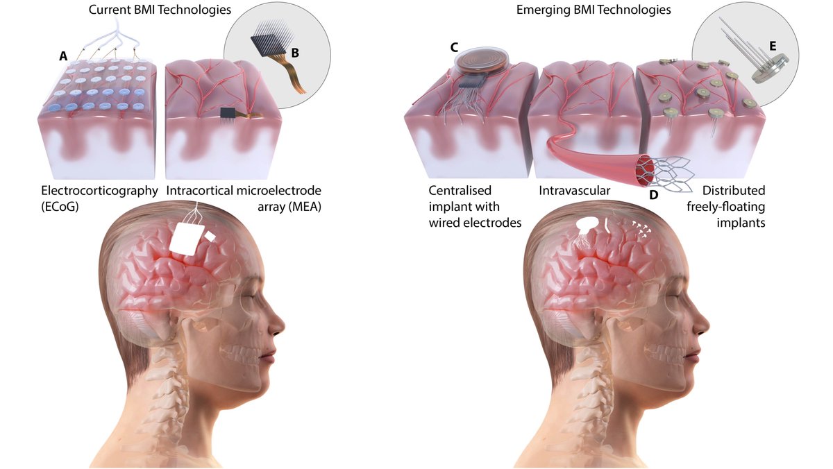 As efforts in implantable brain-machine interfaces progress from basic research to first-in-human studies, clinical and commercial translation will soon become reality. Read about this in our short review article in #COBIOT sciencedirect.com/science/articl… <a href="/adyrapeaux/">Adrien Rapeaux</a> @imperialngni <a href="/UKDRI/">UK Dementia Research Institute</a>