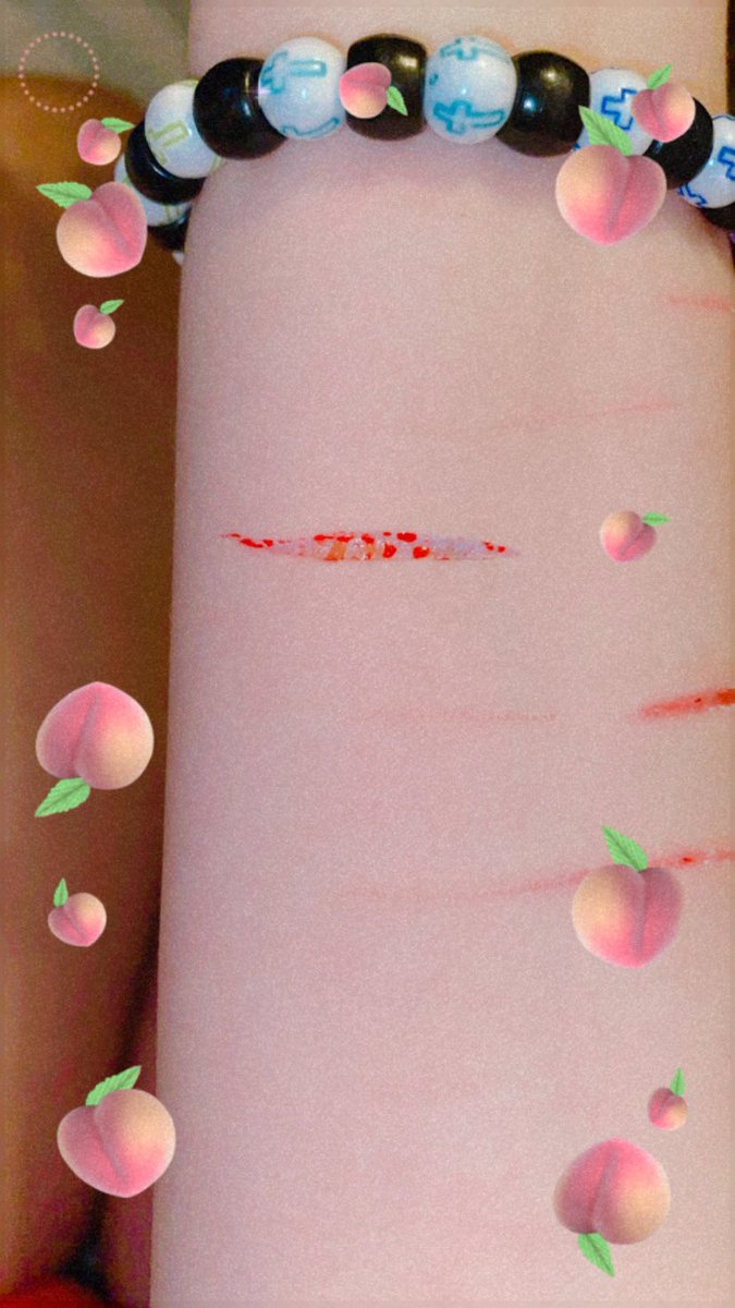RichiesFour's tweet photo. About two weeks old but- y’all see that fat? 😏 https://t.co/sUwQNHGCuS
