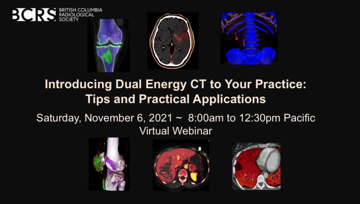 DrHugue's tweet photo. Check It Out!
Speaking Tomorrow Live!
@BCRadSoc
https://t.co/VtHGbcA56n

@DrIanWeissman @Vilavaite @jennybencardino @VGHEmergRad @EmergTraumaRad @RadNicM @dflemosmd @Baez1Adan @JulioBGuimaraes @carlespedret @FriedbergEric @AdamSingerMD @JanFritzMSK @SoteriosGyft @GSERRANOB_MSK https://t.co/Gi4ocDPQEX
