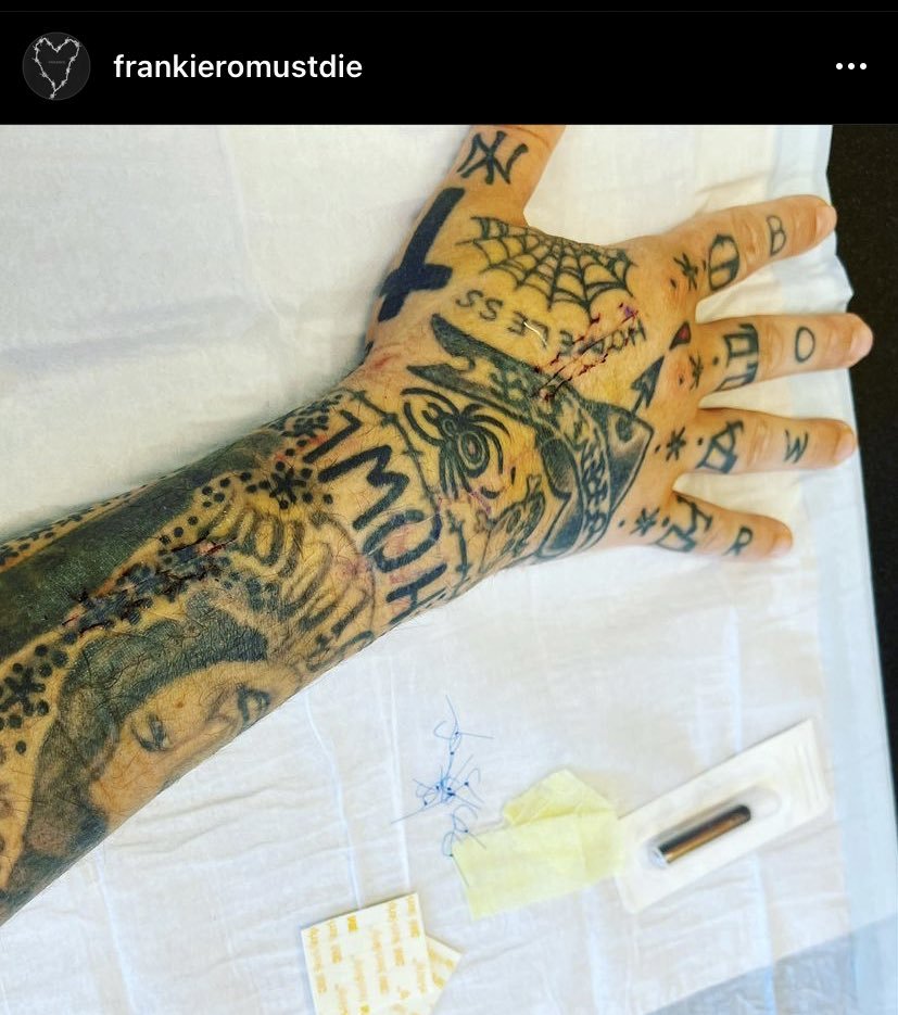 schlongferatu's tweet image. idk anything about surgery but couldnt they sew it back like... normally