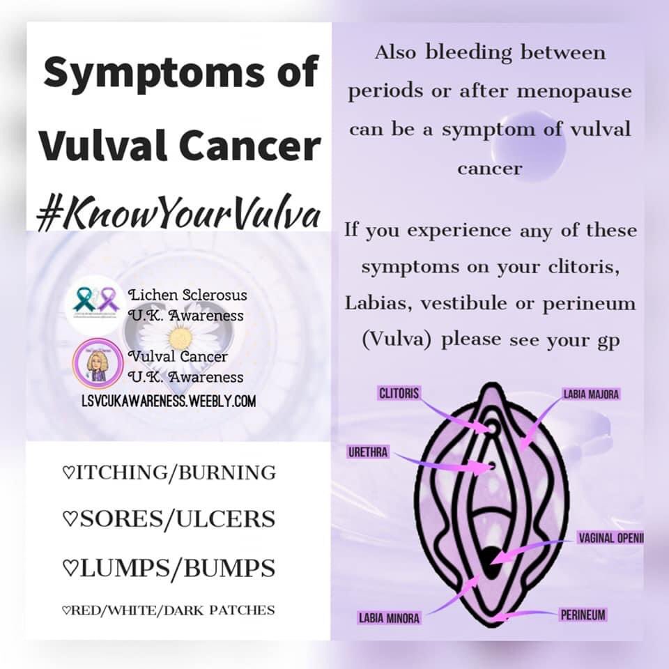 VulvalCancerUK's tweet photo. #Vulvalcancer symptoms vary from person to person, some may experience a sore or ulcer that doesnt respond to treatment whilst someone else may feel a lump or have persistent itching and/or burning sensations on the vulva.
#KnowYourVulva #VulvalCancerAwarenessWeek https://t.co/jyOY9V5X1l