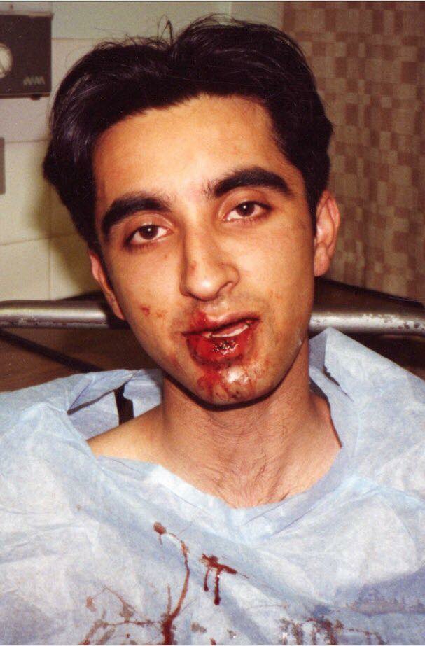 AamerAnwar's tweet photo. 30yrs ago today I was subjected to racist attack by a Glasgow Police Officer- after smashing my teeth out,he told me ‘This is what happens to black boys with big mouths’ Since that night I learned justice is never given to you, you always have to fight for it #NoJusticeNoPeace https://t.co/nsffMei41v