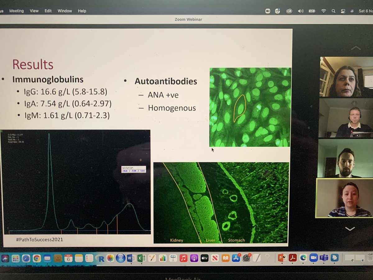 PathologyHouse's tweet photo. Immunology is fascinating! One of the smaller & perhaps lesser-known path specialties but no less important for patients! Listening to Dr Anne Boulton/Dr Ben Hall describe the immunology results for our patient! #PathToSuccess2021 #PathologyWeek #AllTogetherNow @dralirobb @RCPath https://t.co/5oHZ1m5Wir