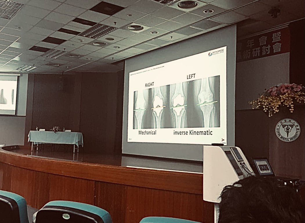 PhilipWdG's tweet photo. Thank you to #CAOS #Taiwan 🇹🇼 for the kind invitation. #speciallecture As the Asian population is prone to #varus, patient specific or personalized alignment is even more effective in the East 🌏
#patientspecific #tka #inversekinematicalignment #iKA @az_delta @OrthoRoeselare https://t.co/vVL6CJt6K6