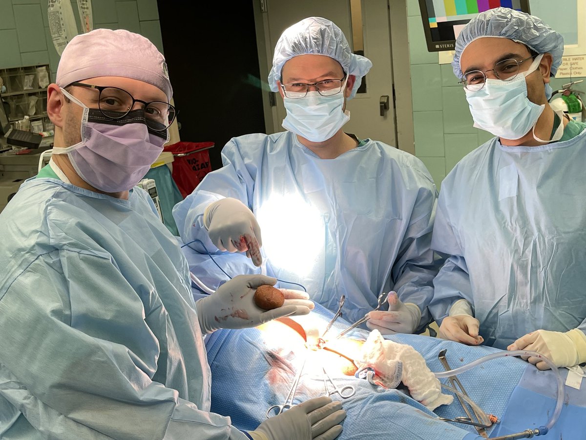 TulaneUrology's tweet photo. Our UMC team did a cystolithotomy yesterday for this large bladder stone! #bladderstonesurgery https://t.co/N7urSQTDE5