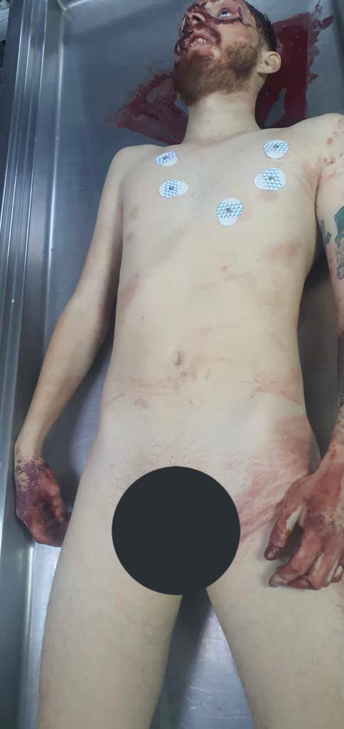 Jalisco_Rojo's tweet photo. Imágenes del cuerpo de #OctavioOcañas alias #Benito #justiciaparaoctavioocaña https://t.co/rJB42A4C0d