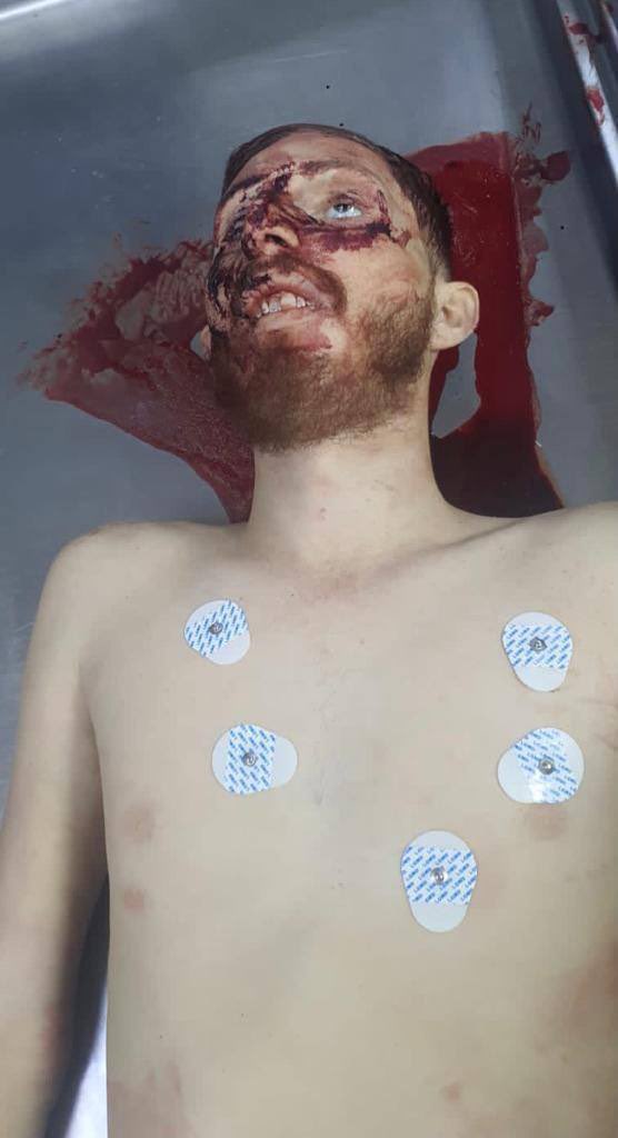 Jalisco_Rojo's tweet photo. Imágenes del cuerpo de #OctavioOcañas alias #Benito #justiciaparaoctavioocaña https://t.co/rJB42A4C0d