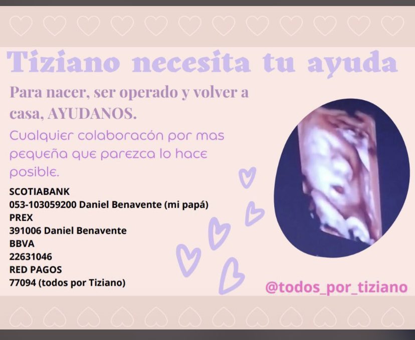 manya_katy's tweet photo. @veleznazarena Hola Naza, necesitamos de tu ayuda Tiziano fue diagnosticado con una cardiopatía congénita severa y necesita ser operado en argentina. Las 3operaciones son muy caras, podrías ayudarnos a difundir somos de Uy xfavor. Si ig es (@todos_por_tiziano) 🙏🏼🙏🏼🙏🏼 https://t.co/GlEnvx3HXA