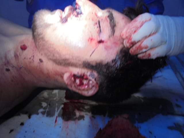 TurkeyUrduNews's tweet photo. اللہ اکبر پانچ سال بعد آج ان کی لاش بغیر کسی تبدیلی کے ملی اور وہ اسی حالت میں ہے جس حالت میں وہ شہید ہوئے تھے
پانچ سال قبل کابل میں امریکی درندگی کا نشانہ بننے والے حافظ کفایت اللہ شہید
جن کی لاش درندوں نے حوالے نہیں کی تھی اب امارت نے ان کی لاش برآمدکی تو وہ تازہ حالت میں تھی https://t.co/KoUnN6MAqw