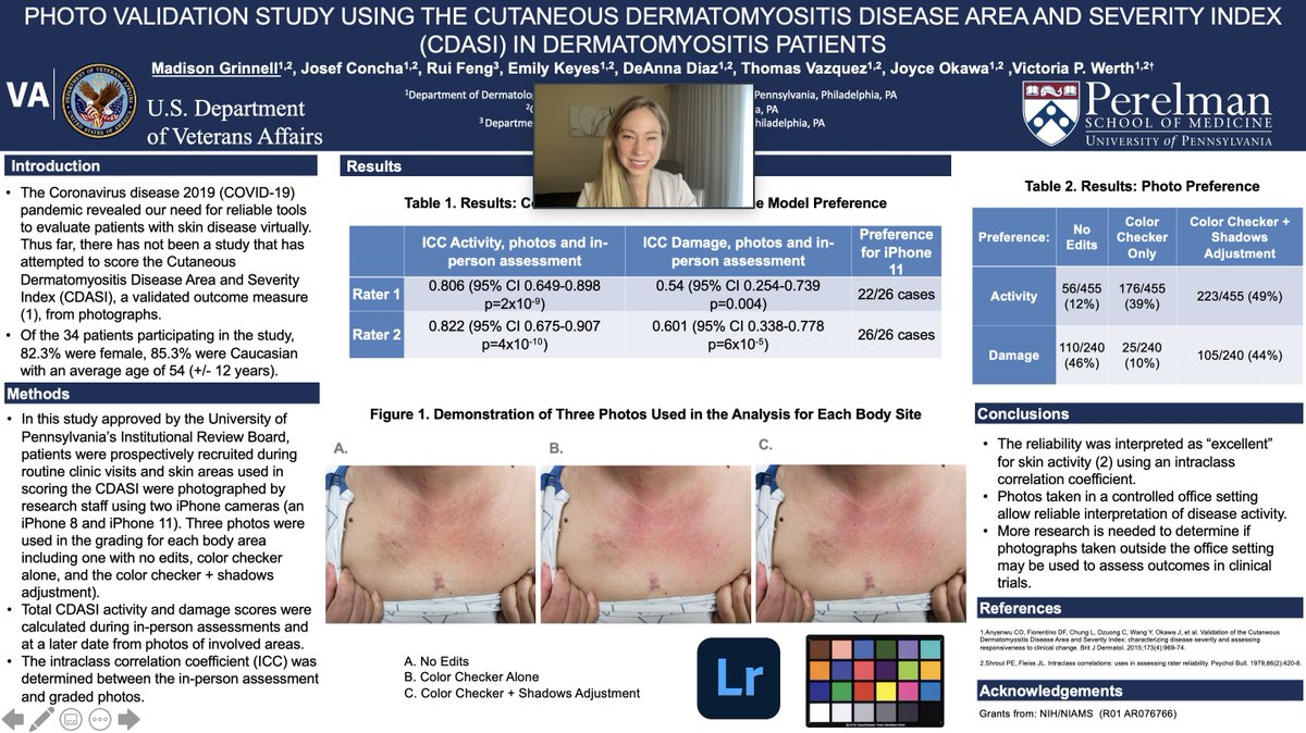 artmajormd's tweet photo. Loved presenting our @werthlab research @RheumDermSoc ! #teledermatology #CDASI #dermatomyositis #dermtwitter #medicalphotography πΈπ€³ https://t.co/bklCZiEyQH