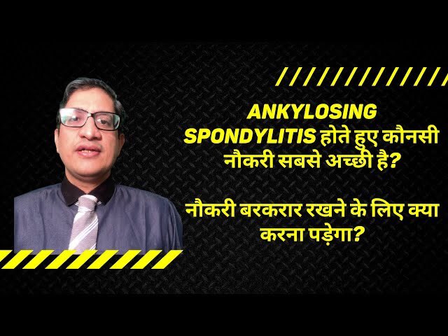doctorakerkar's tweet image. Ankylosing spondylitis होते हुए कौनसी  नौकरी अच्छी है? नौकरी बरकरार रखने के लिए क्या करना पड़ेगा?
youtu.be/h5H0xUVquzM