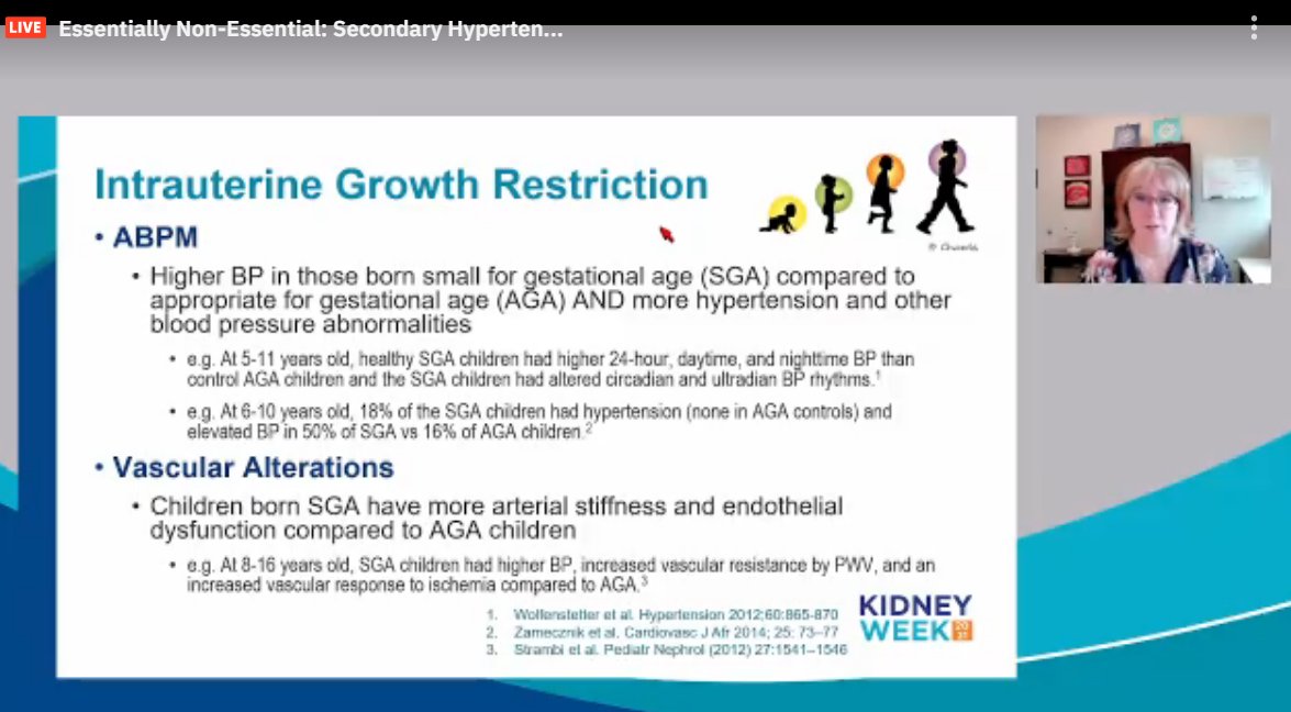 drM_sudha's tweet photo. Premature: directly proportional
Birth wt: controversial data. U/ J shaped association
IUGR asso #HTN. early arterial stiffness &endothelial dysfunction
Growth: early rapid wt gain--> increase HTN. But better neurocognitive scores
BF: lower BP
#ASNKids21 #KidneyWk #PedsHTN https://t.co/xSXOsgUEQK