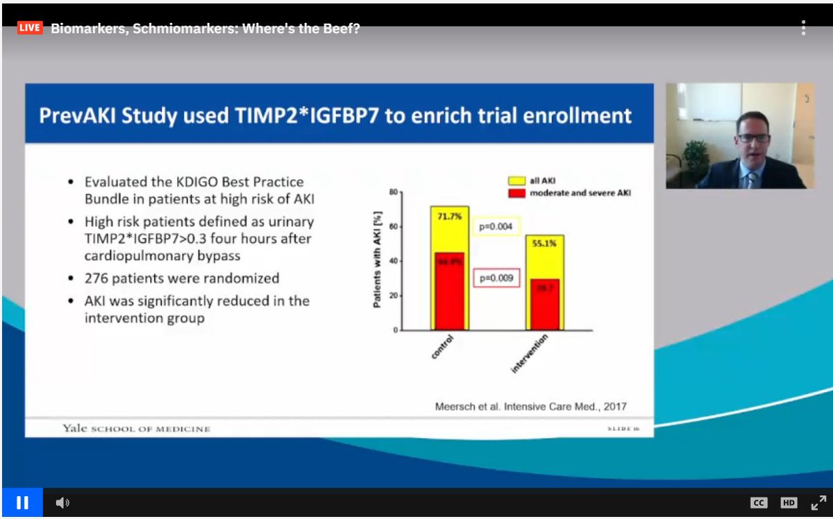 drM_sudha's tweet photo. #TIMP2 #IGFBP2 identified high risk patients sooner
#ASNKids21 #KidneyWk #Biomarkers #AKI
@ASPNeph @AspnResearch @ASNKidney https://t.co/6TJlqU0THZ