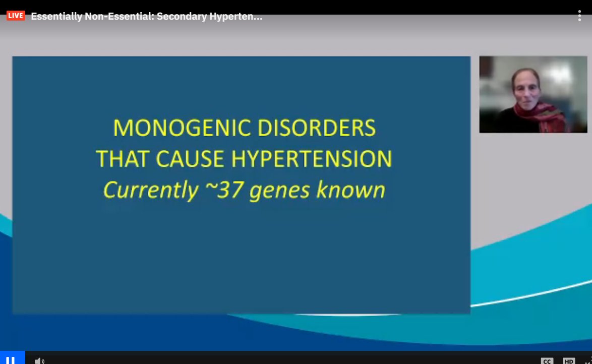 drM_sudha's tweet photo. Currently, 37 genes known.
when to suspect #monogenicHTN
1. family Hx
2. severely suppressed plasma renin
3. Hypokalemia Hypertension
4. syndromic features
5. Young children
#ASNKids21 #KidneyWk #HTN #secondaryHTN #PedsHTN
@ASPNeph @AspnResearch @ASNKidney https://t.co/k9Y1kfoj2a