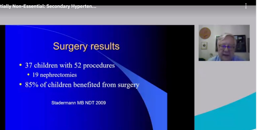 drM_sudha's tweet photo. intrarenal RAS- nephrectomy
#Teamapproach
#ASNKids21 #KidneyWk #HTN #PedsHTN #renovascularHTN #SecondaryHTN
@ASPNeph @AspnResearch @ASNKidney https://t.co/JW1fN5xNQm