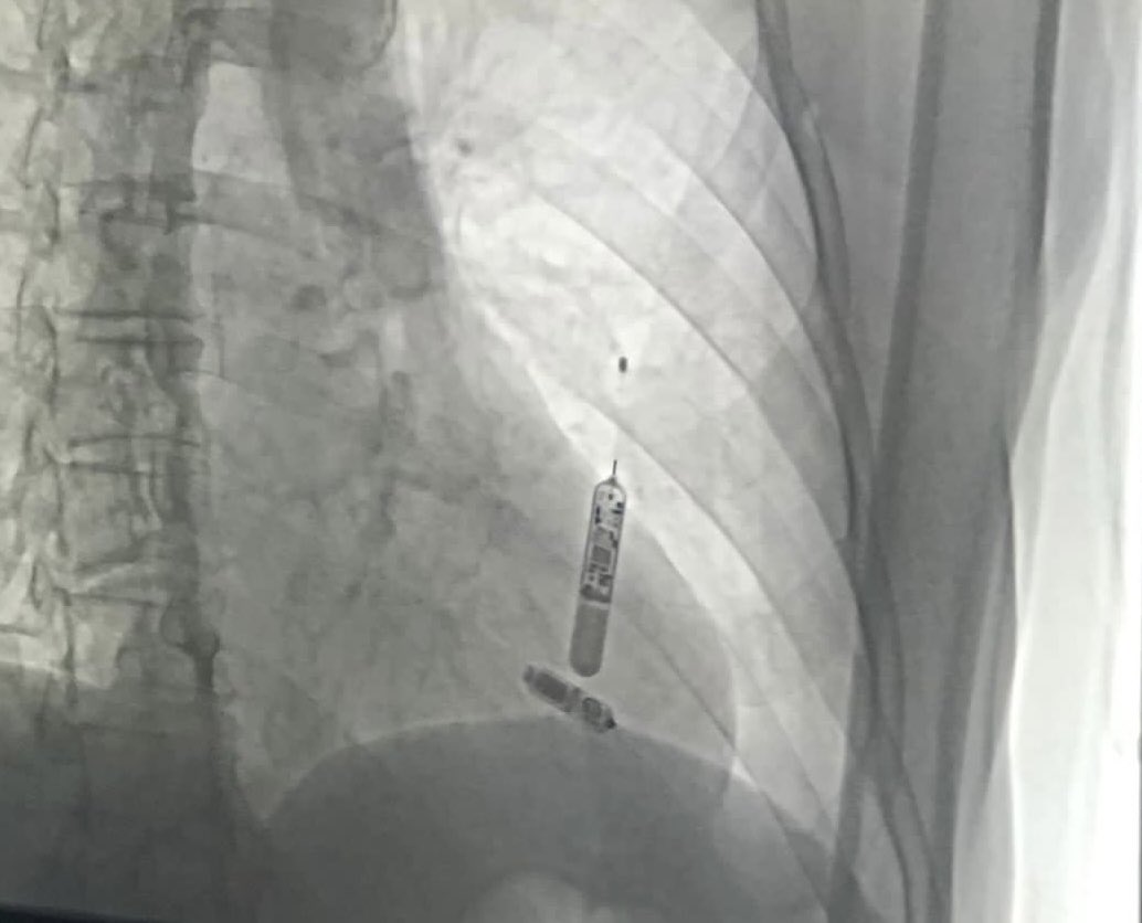 Anibal Pires Borges tweet media