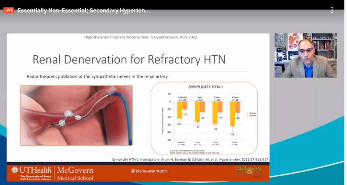 drM_sudha's tweet photo. Renal sympathetic may be the Gordian Knot of BP control
Renal denervation via radio ablation is used for refractory HTN
#ASNKids21 #KidneyWk #HTN #secondaryHTN #PedsHTN #HPAaxis
@ASPNeph @AspnResearch https://t.co/ESe6AXa0v7