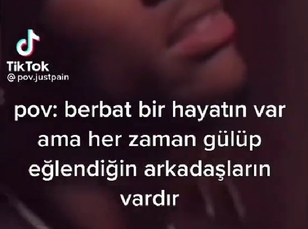 akoyamv's tweet photo. Olmayanlar napsin peki https://t.co/nujtHulFaI