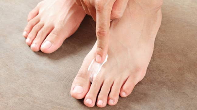 Home remedy to cure athletes foot 

- Rains brings joy and so is the importance of foot care

-Athel...