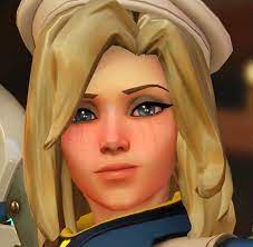 OverwatchGG's tweet photo. It's always "What is the healer doing?" 
Never "How is the healer doing?" https://t.co/xKXHt3t31l