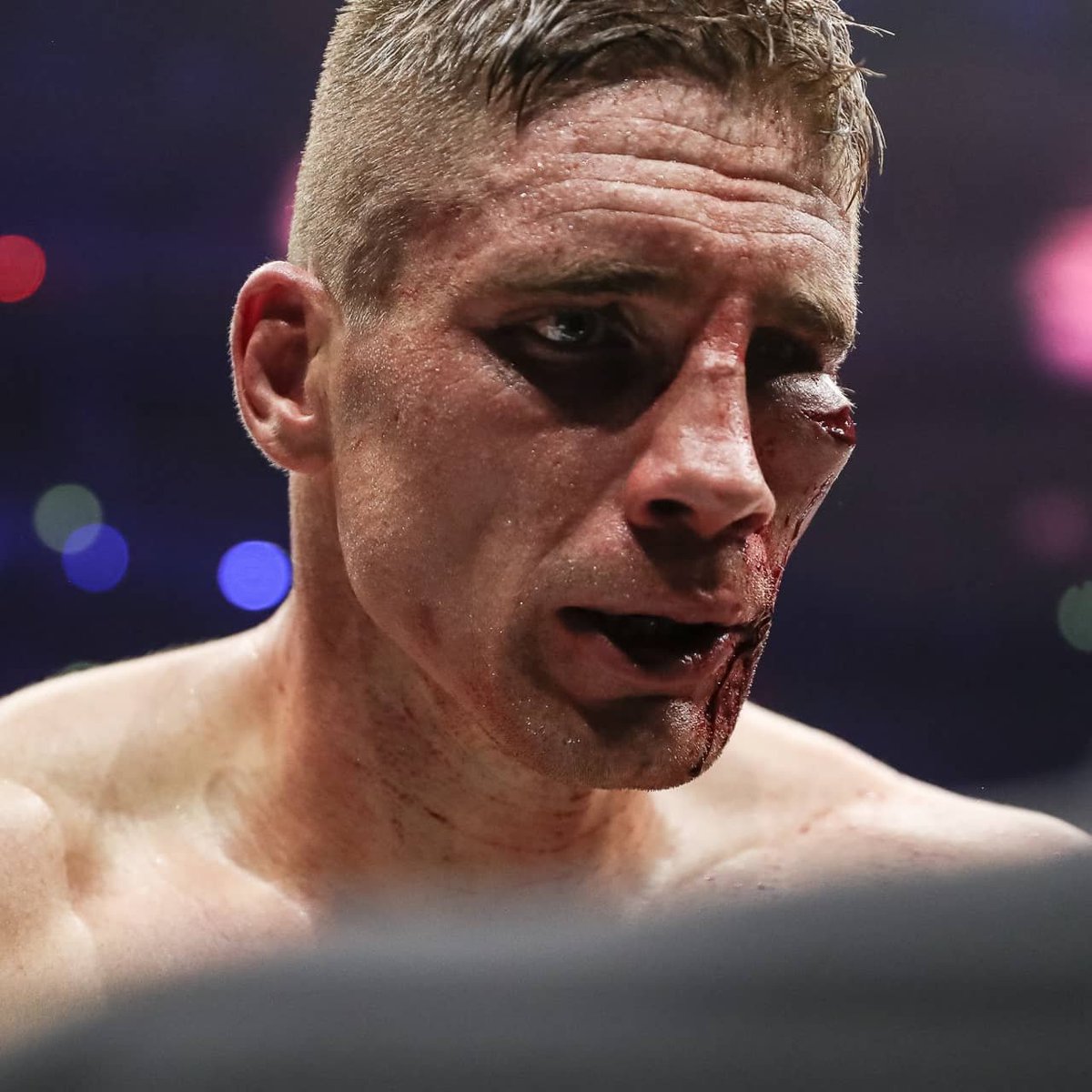GLORY_Brasil's tweet photo. Sem cicatriz, sem história.🩸🥊 

@RicoVerhoeven 🇳🇱 #COLLISION3/#GLORY79 

#glorykickboxing #kickboxing https://t.co/C9OeTgks6J